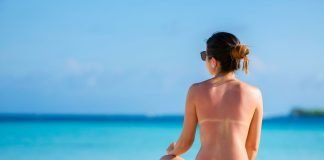 topless precauzioni e rischi