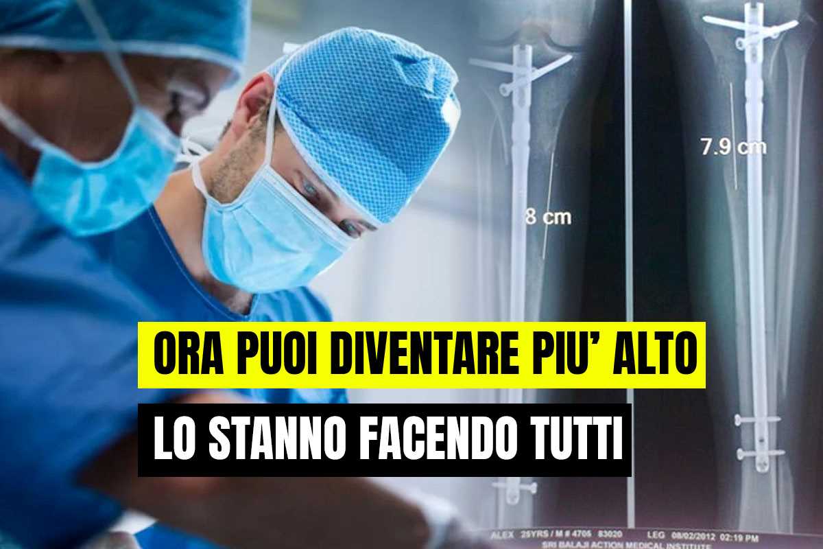 Chirurgia per diventare pù alti