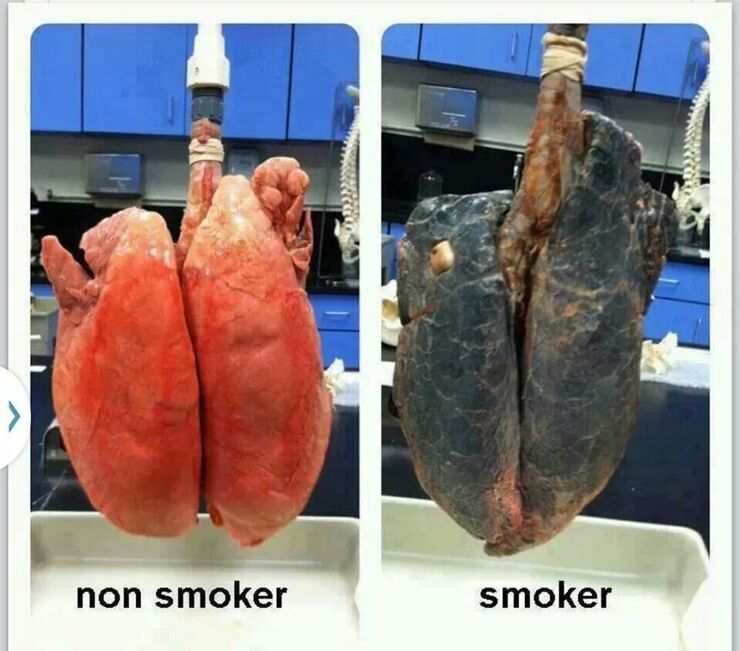 polmoni a confronto