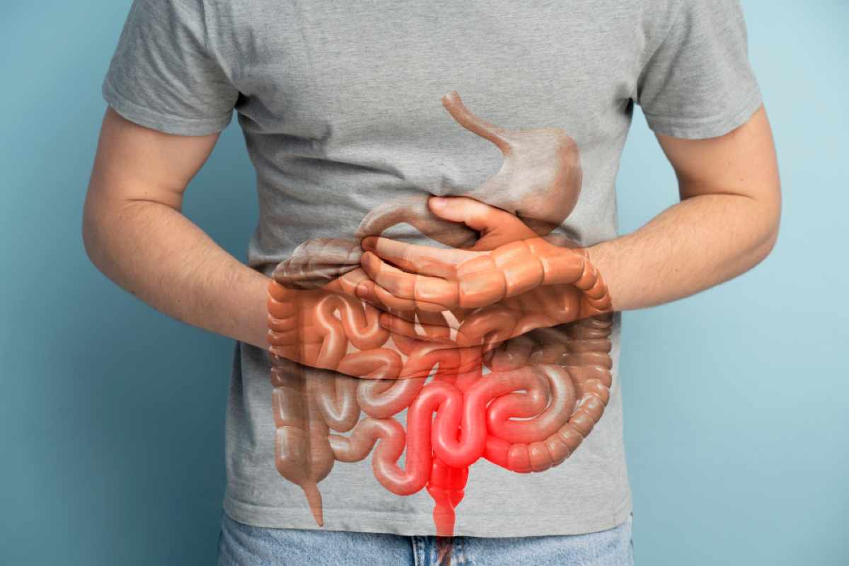 Intestino irritabile questi alimenti